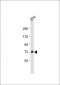 Zebrafish dlc Antibody (C-Term)